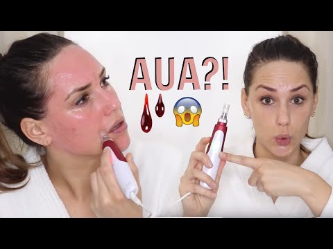 MICRONEEDLING FÜR ANFÄNGER | DERMAPEN TUTORIAL ANLEITUNG || KathisFinest