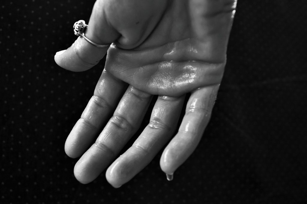 Hyperhidrose Hand